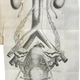 Illustration for article titled Own a Piece of Morbid Medical History